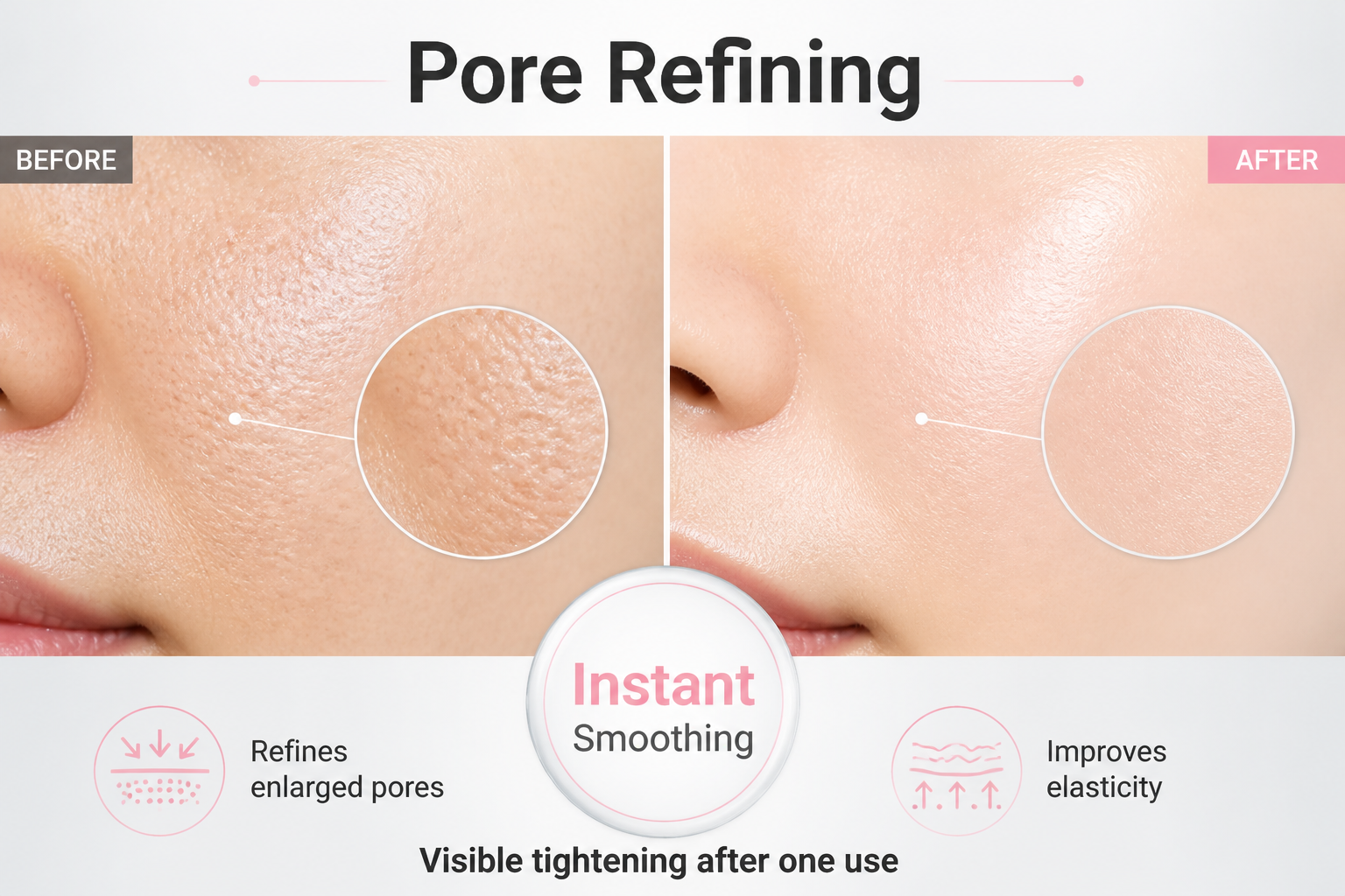 Primary benefit: Visualizing pore reduction